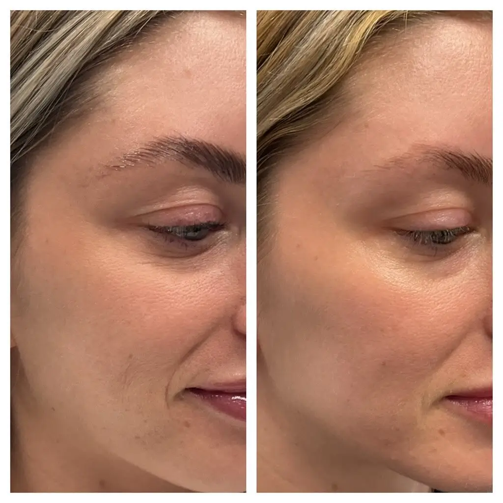 Skinvive Before and After