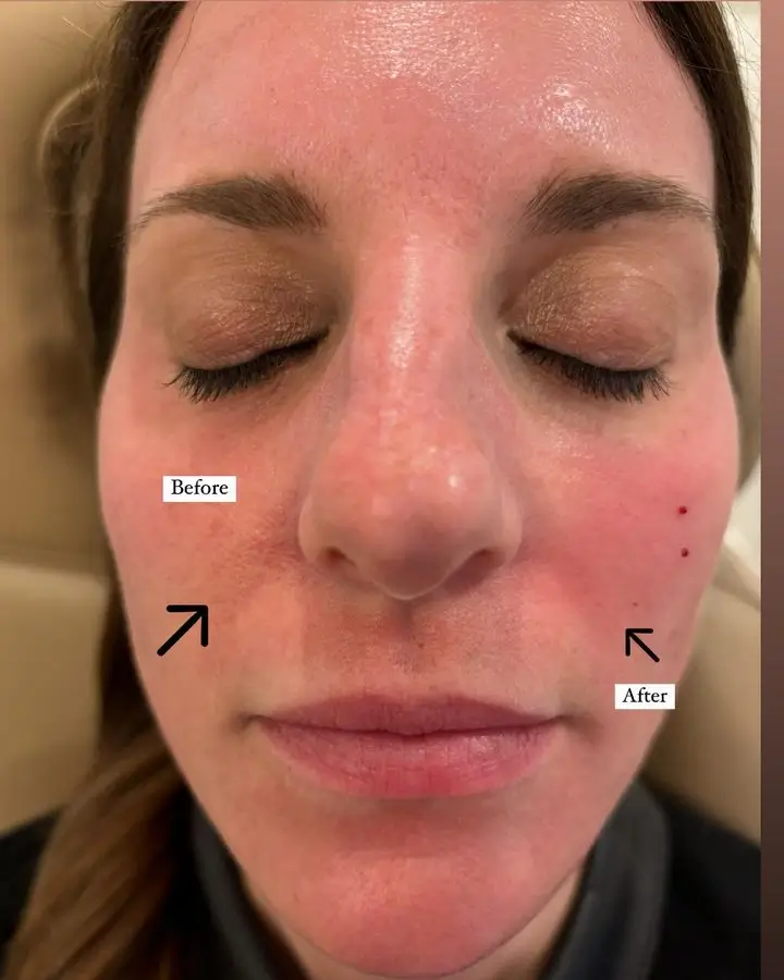 Skinvive Before and After