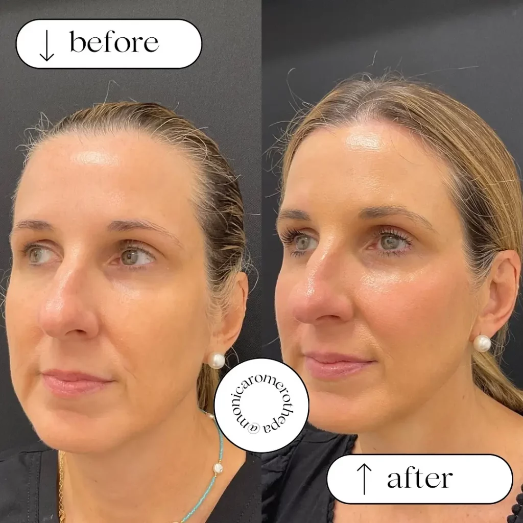 Skinvive Before and After