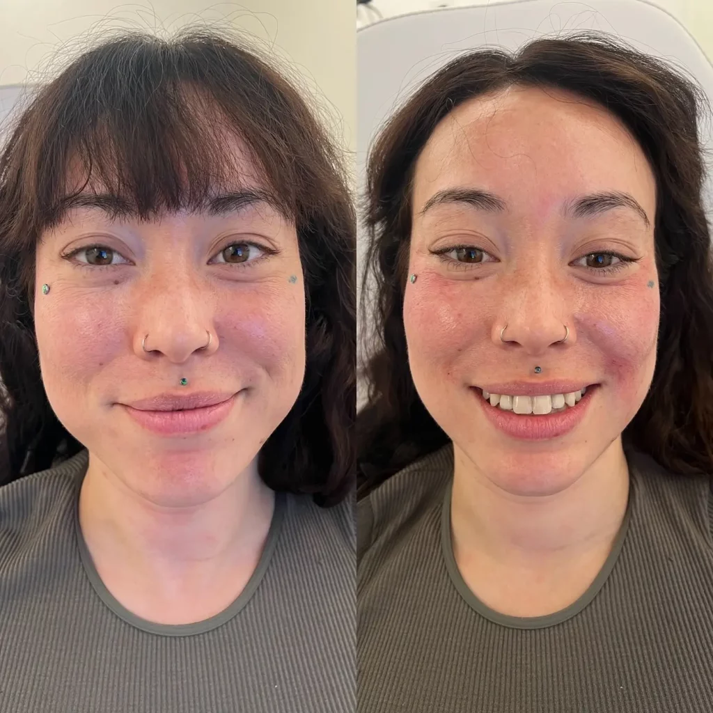 Skinvive Before and After