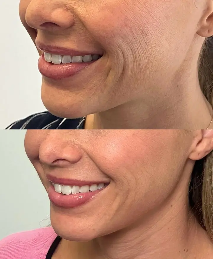 Skinvive Before and After